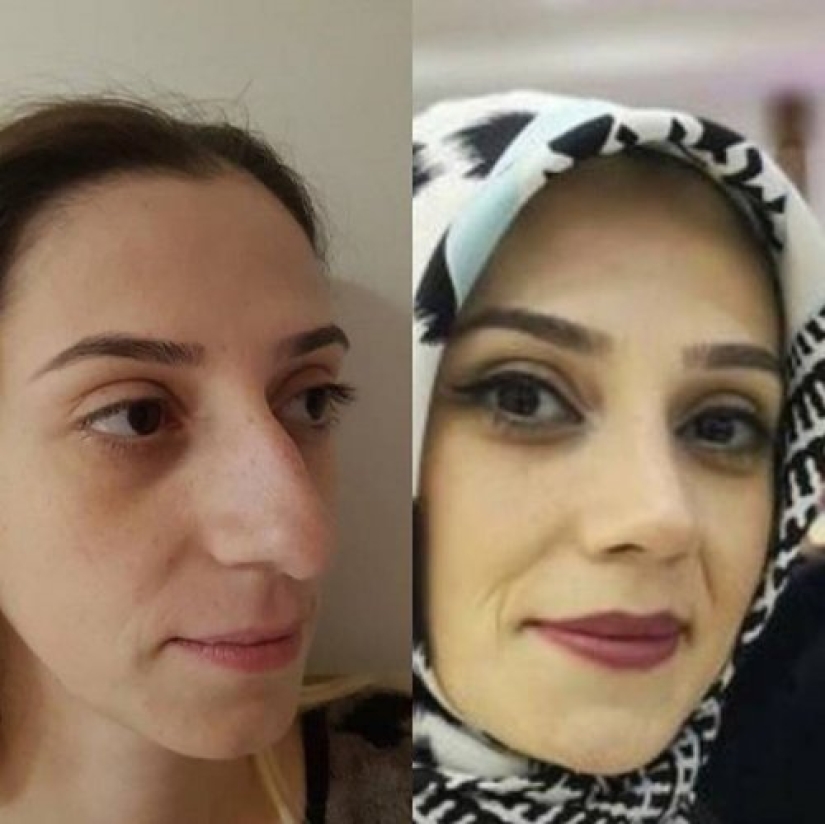 Niñas antes y después de un solo cambio de apariencia Niñas antes y después de un solo cambio de apariencia