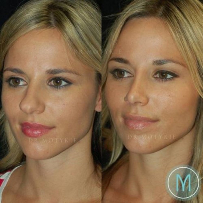 Niñas antes y después de un solo cambio de apariencia Niñas antes y después de un solo cambio de apariencia