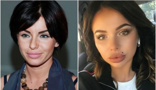 "No labios, sino albóndigas": 8 estrellas rusas que se excedieron en la ampliación "No labios, sino albóndigas": 8 estrellas rusas que se excedieron en la ampliación