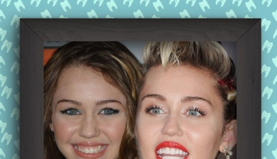 Non-Hollywood smiles of stars at the beginning of their career