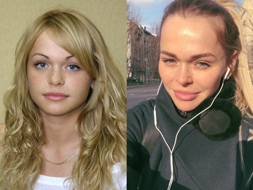 "Not lips, but dumplings": 8 Russian stars who overdid the magnification