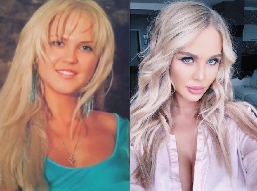 "Not lips, but dumplings": 8 Russian stars who overdid the magnification