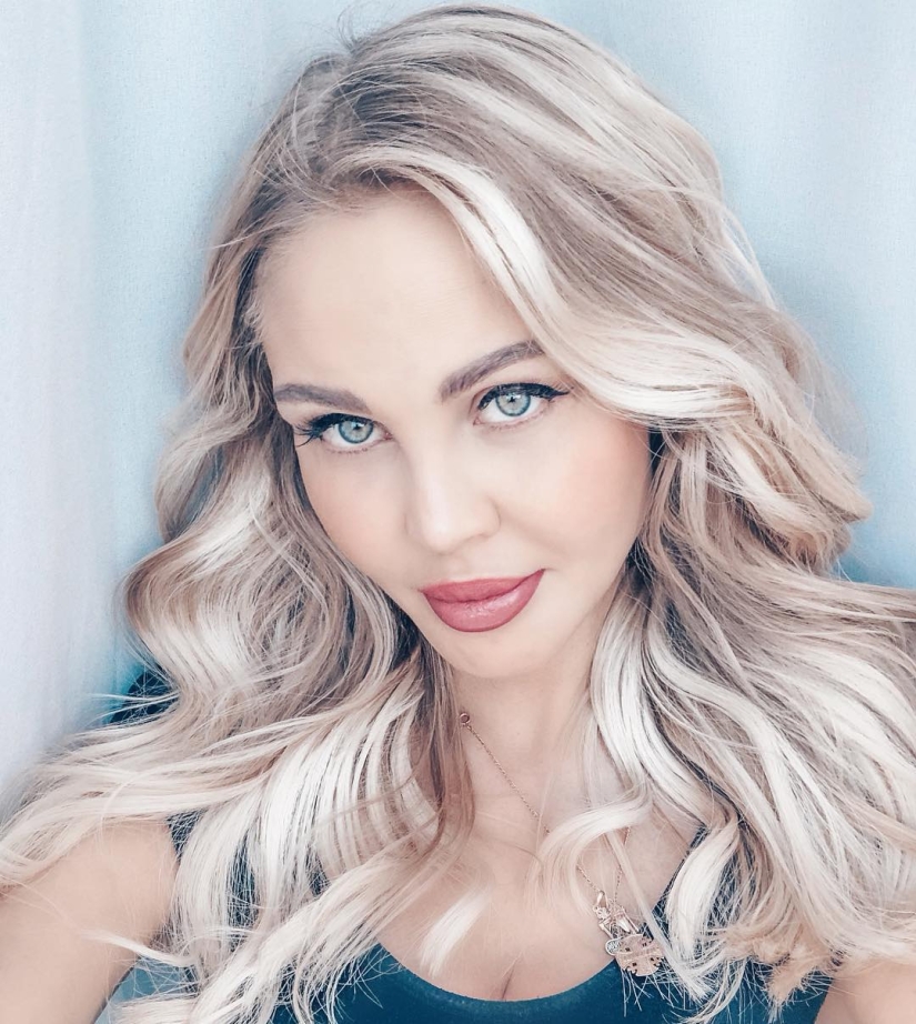 "Not lips, but dumplings": 8 Russian stars who overdid the magnification