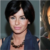 "Not lips, but dumplings": 8 Russian stars who overdid the magnification