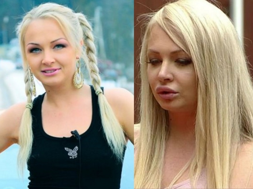 "Not lips, but dumplings": 8 Russian stars who overdid the magnification