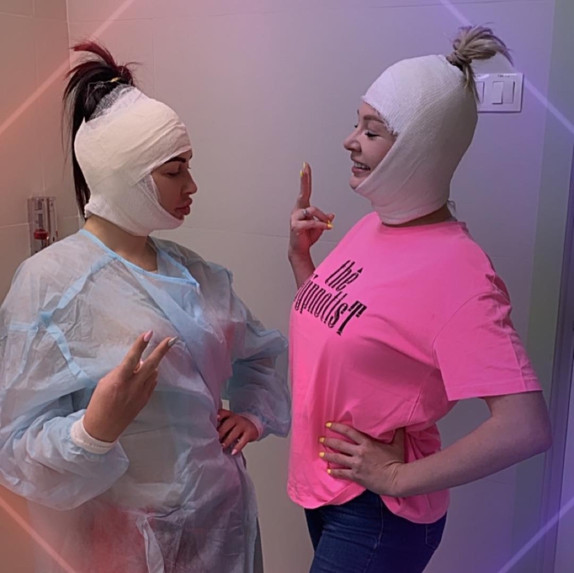 "Not lips, but dumplings": 8 Russian stars who overdid the magnification