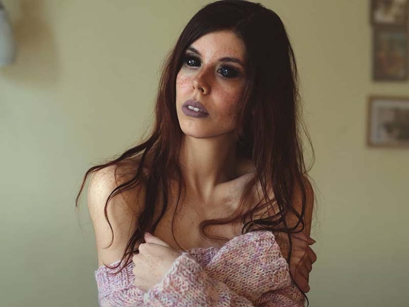 Ojos negros: modelo de Polonia se quedó ciego después de tatuarse los ojos