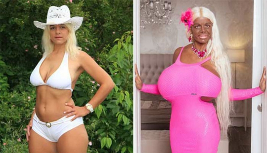 Para el avión, me bajo: ex azafata enganchada al bronceado y al aumento de senos