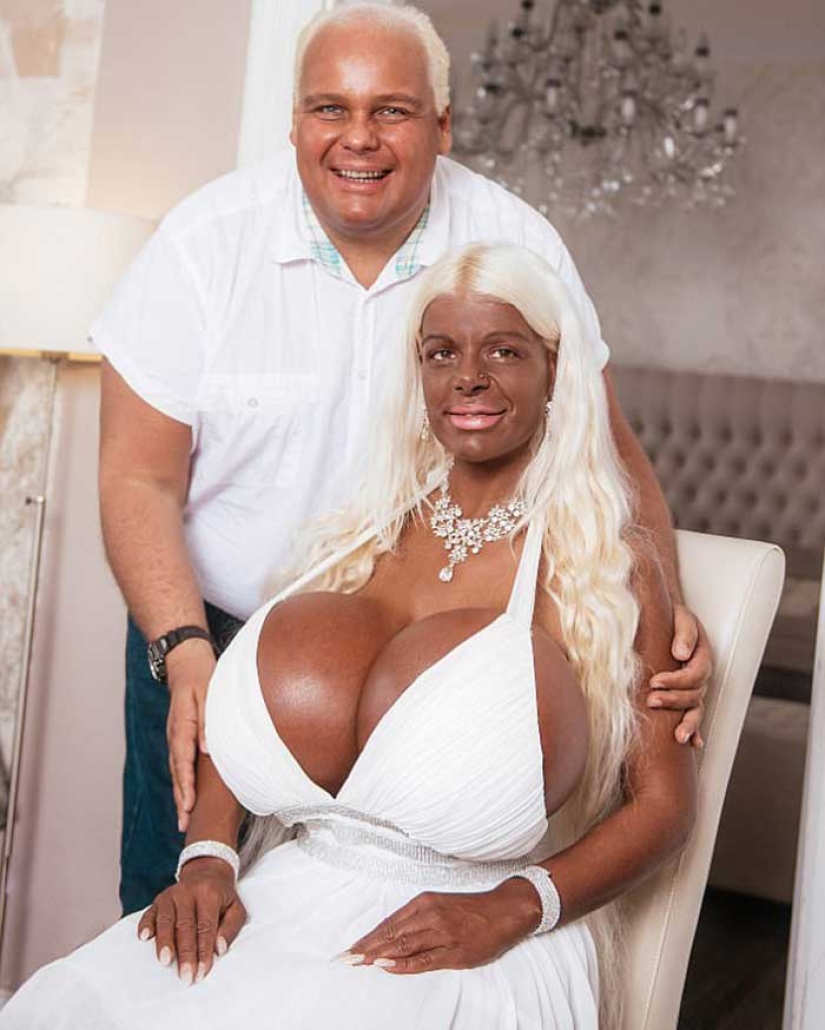 Para el avión, me bajo: ex azafata enganchada al bronceado y al aumento de senos