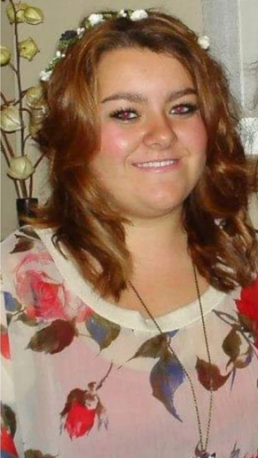 Pérdida de peso accidental: una niña perdió 57 kg mientras paseaba a un perro