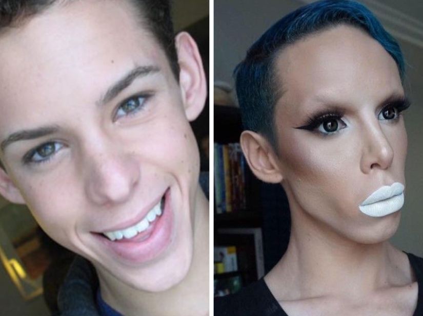 Plastic surgery victims - men Plastic surgery victims - men