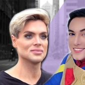 Plastic surgery victims - men