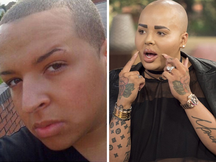 Plastic surgery victims - men Plastic surgery victims - men