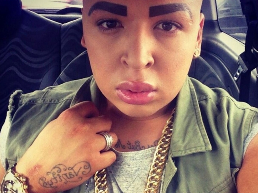 Plastic surgery victims - men Plastic surgery victims - men