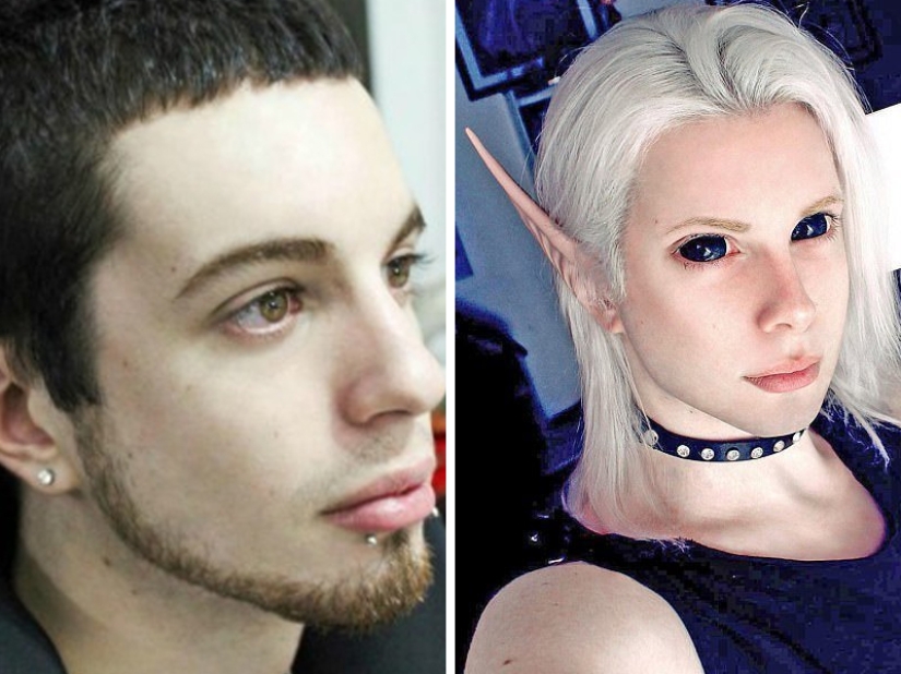 Plastic surgery victims - men Plastic surgery victims - men