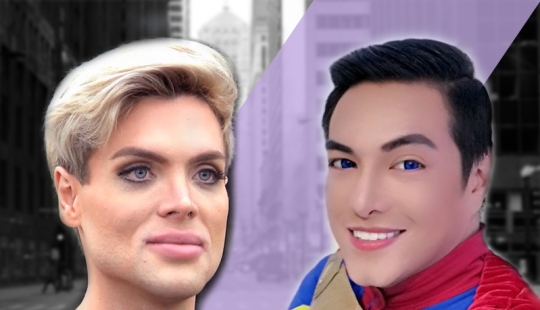 Plastic surgery victims - men