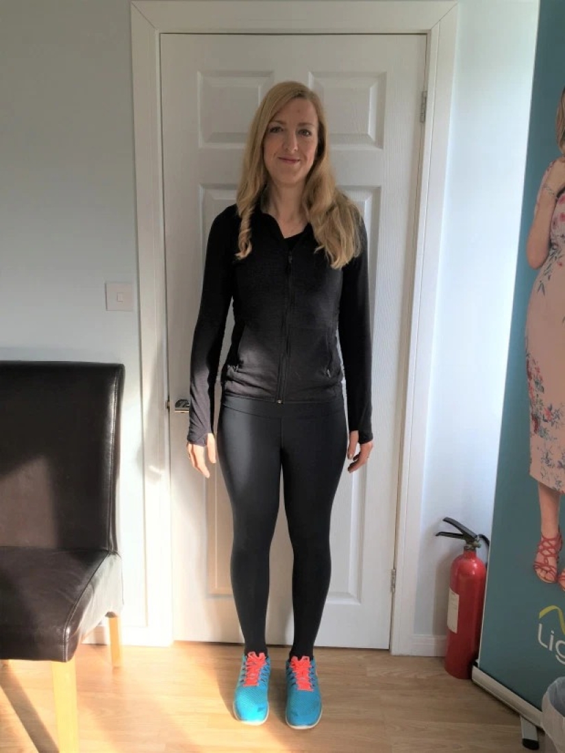 Pulled herself together: the woman got rid of snoring and lost 89 kg, refusing gastric banding