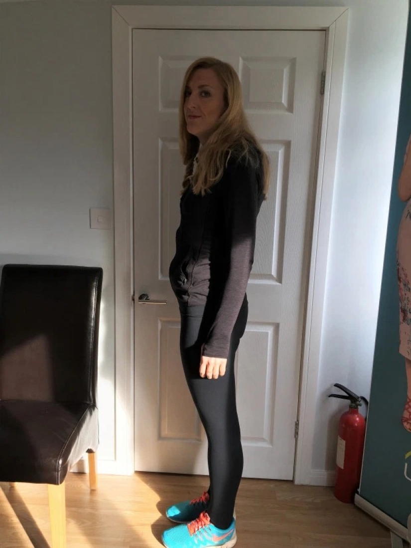 Pulled herself together: the woman got rid of snoring and lost 89 kg, refusing gastric banding