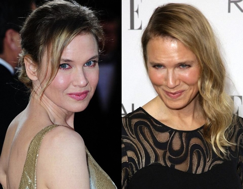 ¿Qué pasó con René Zellweger?
