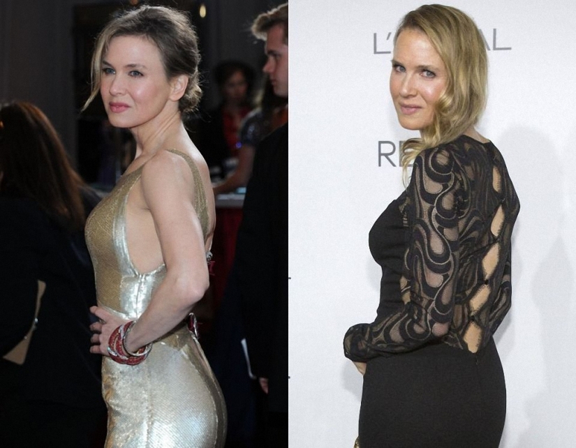 ¿Qué pasó con René Zellweger?
