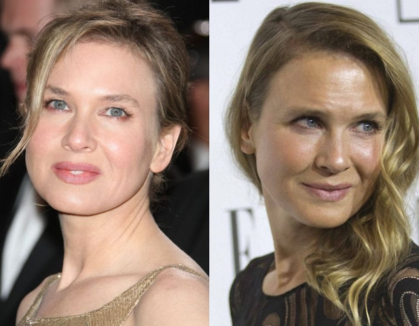 ¿Qué pasó con René Zellweger?