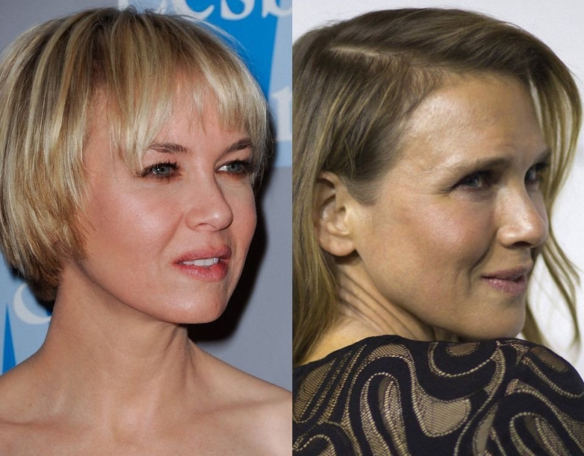 ¿Qué pasó con René Zellweger?