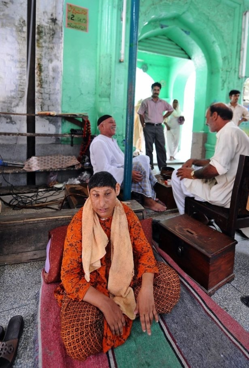 "Rats of Shah Daula": children from Pakistan with deformed skulls and a hard fate