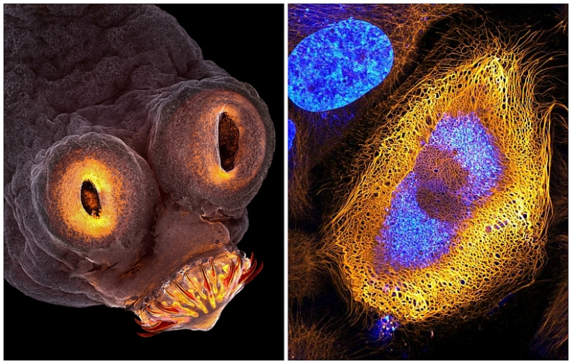 Sex of weevils, the head of a worm, the beauty of mold: Nikon Small World photo contest announced the winners
