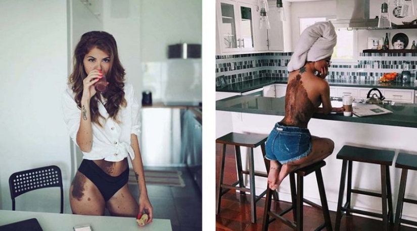 Signos especiales: debido a las marcas de nacimiento, la niña fue apodada "dálmata", pero se considera sexy