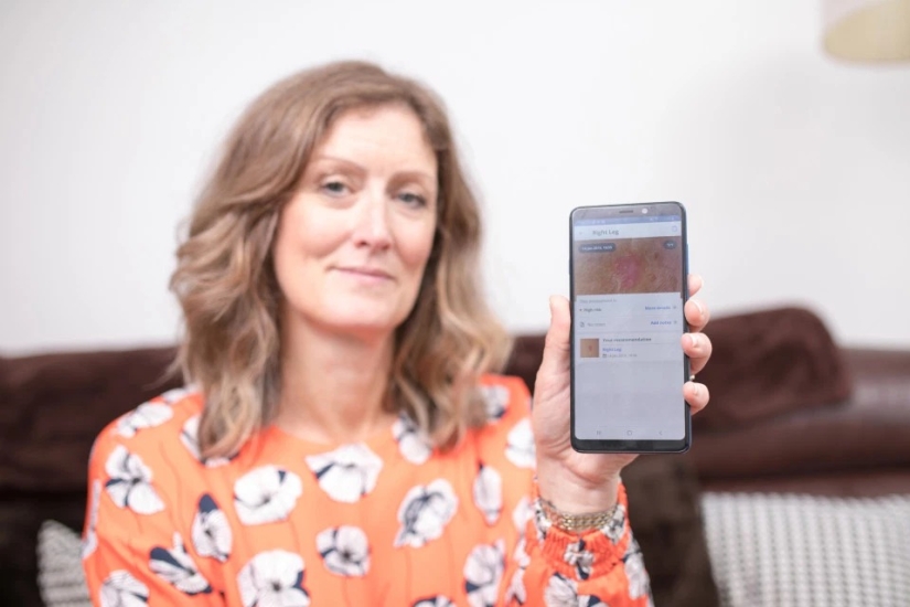 Solar coffin: these women have acquired a nice tan and skin cancer after Solarium Solar coffin: these women have acquired a nice tan and skin cancer after Solarium