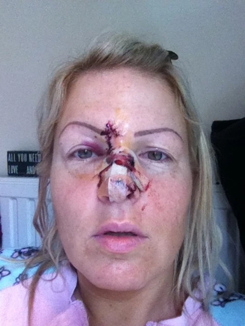 Solar coffin: these women have acquired a nice tan and skin cancer after Solarium Solar coffin: these women have acquired a nice tan and skin cancer after Solarium