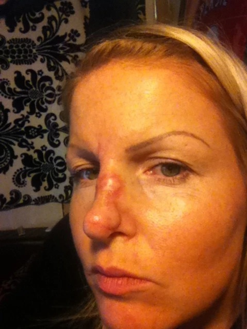 Solar coffin: these women have acquired a nice tan and skin cancer after Solarium Solar coffin: these women have acquired a nice tan and skin cancer after Solarium