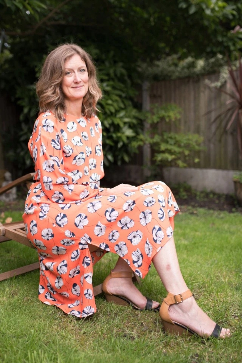 Solar coffin: these women have acquired a nice tan and skin cancer after Solarium Solar coffin: these women have acquired a nice tan and skin cancer after Solarium