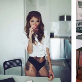 Special signs: because of birthmarks, the girl was nicknamed "Dalmatian", but she considers herself sexy