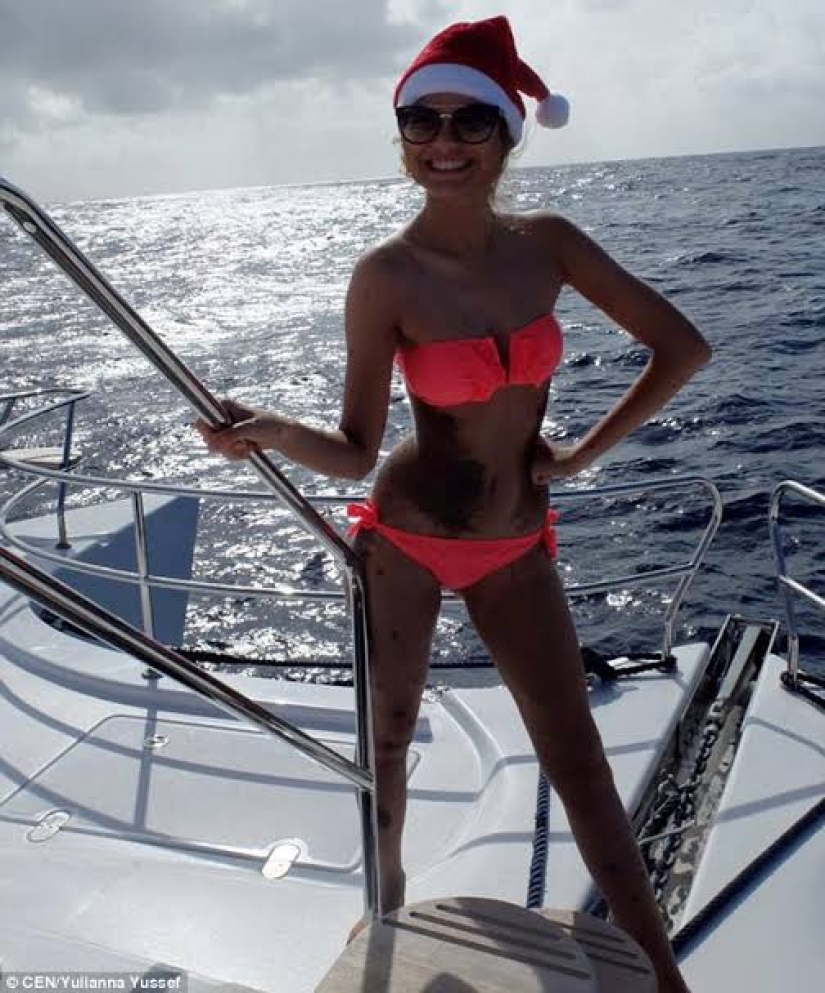 Special signs: because of birthmarks, the girl was nicknamed "Dalmatian", but she considers herself sexy Special signs: because of birthmarks, the girl was nicknamed "Dalmatian", but she considers herself sexy