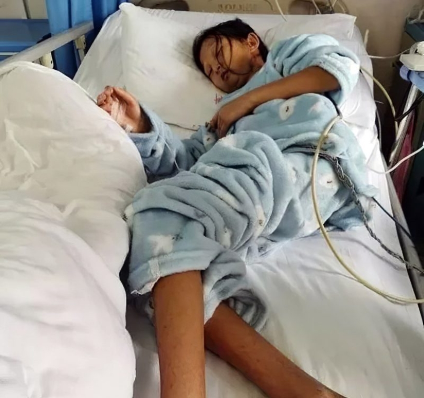 Starved for the sake of saving her brother: a student who had been eating rice for five years died in China Starved for the sake of saving her brother: a student who had been eating rice for five years died in China