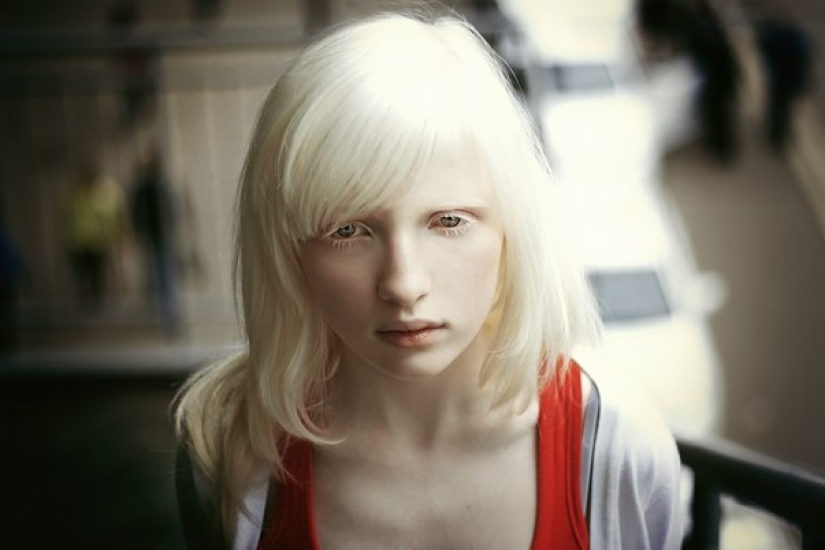 The albino girl, who was an outcast at Moscow school, conquered the fashion world The albino girl, who was an outcast at Moscow school, conquered the fashion world