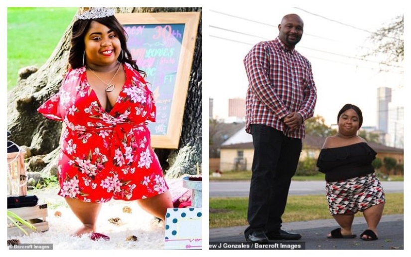 The all-conquering power of love: a girl without arms and legs marries a completely healthy man