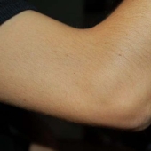 The Amazing and Strange Things the Body Can Do