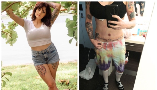 The American woman had her breasts enlarged, had a lift and pumped up her lips instead of reducing her bust The American woman had her breasts enlarged, had a lift and pumped up her lips instead of reducing her bust