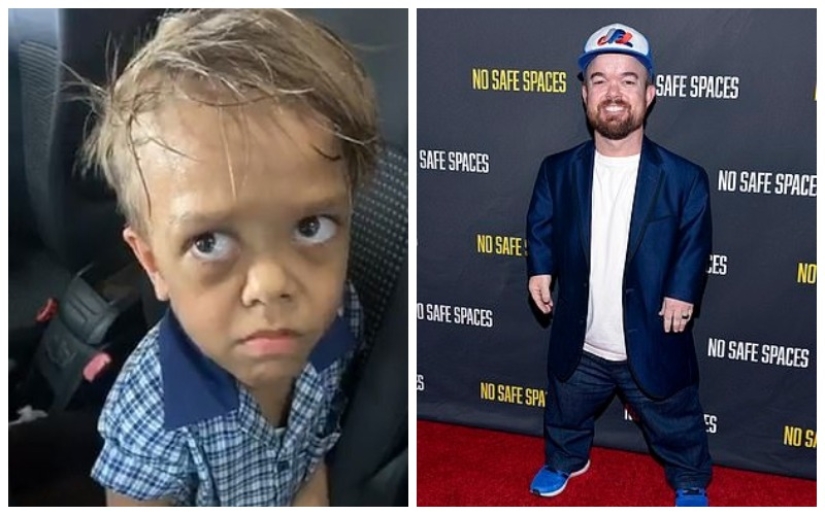 The big heart of a little man: an American comedian raised $ 200,000 to help a dwarf boy