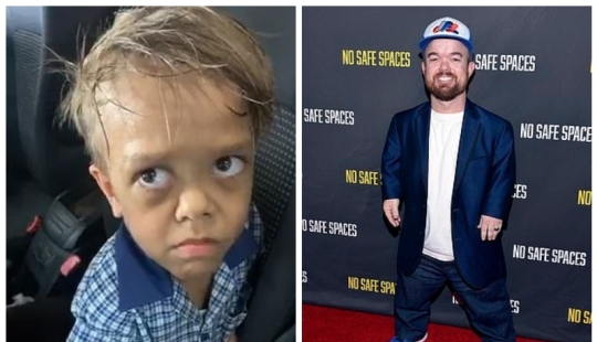 The big heart of a little man: an American comedian raised $ 200,000 to help a dwarf boy