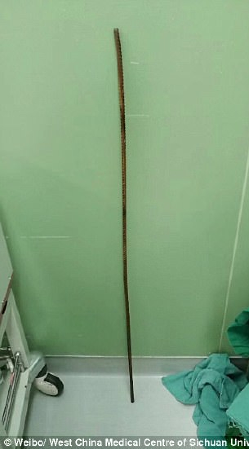 The builder miraculously survived after he was pierced through by a two-meter rebar