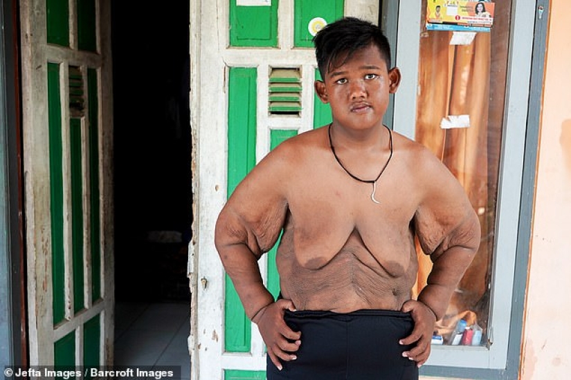 The fattest boy in the world, who weighed 192 kg at the age of 10, lost more than twice as much weight The fattest boy in the world, who weighed 192 kg at the age of 10, lost more than twice as much weight