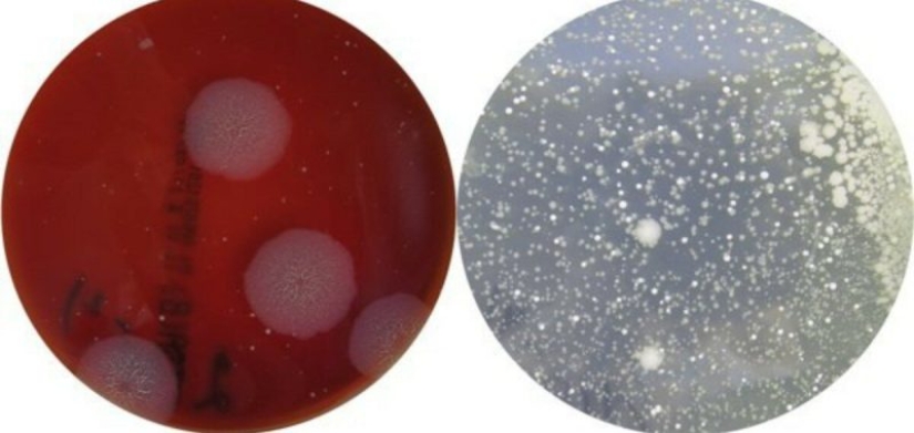 The girl clearly showed the bacterial danger of church icons