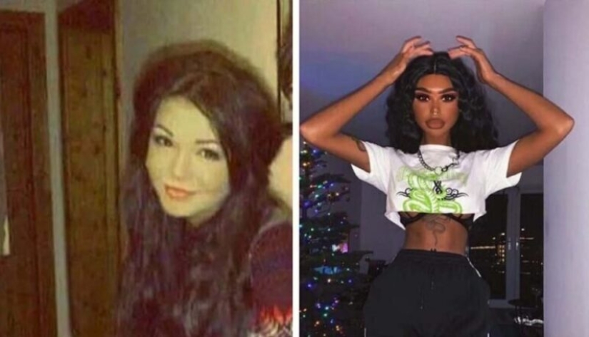 The girl, obsessed with tan, turned into a dark-skinned one. All thanks to the solarium and injections The girl, obsessed with tan, turned into a dark-skinned one. All thanks to the solarium and injections