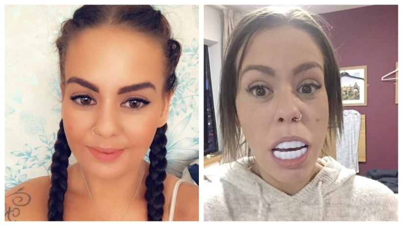 The girl was hysterical when she received a "Hollywood smile" from Amazon