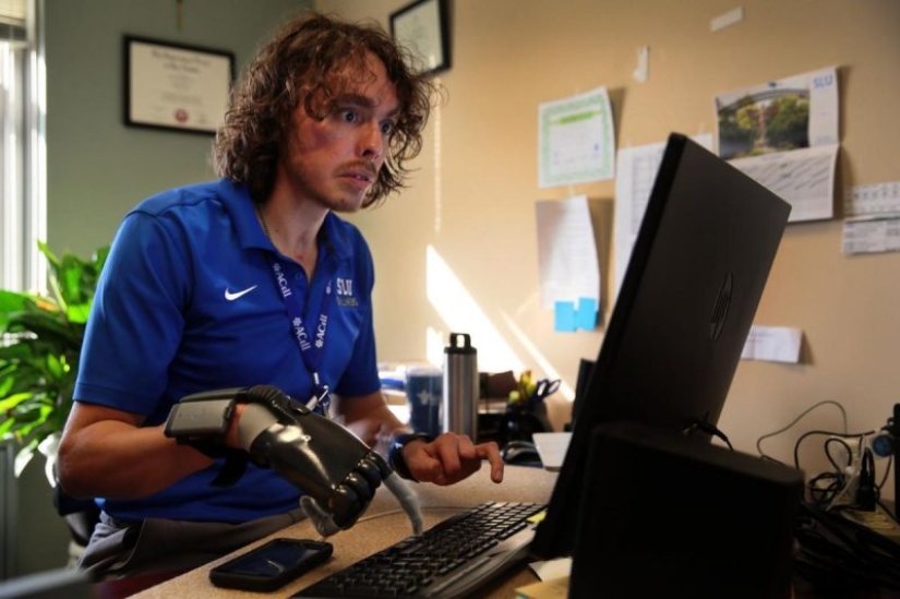 The most famous animal attacks on humans