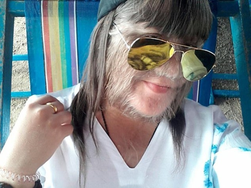 "The most hairy girl in the world" got married and started shaving her face