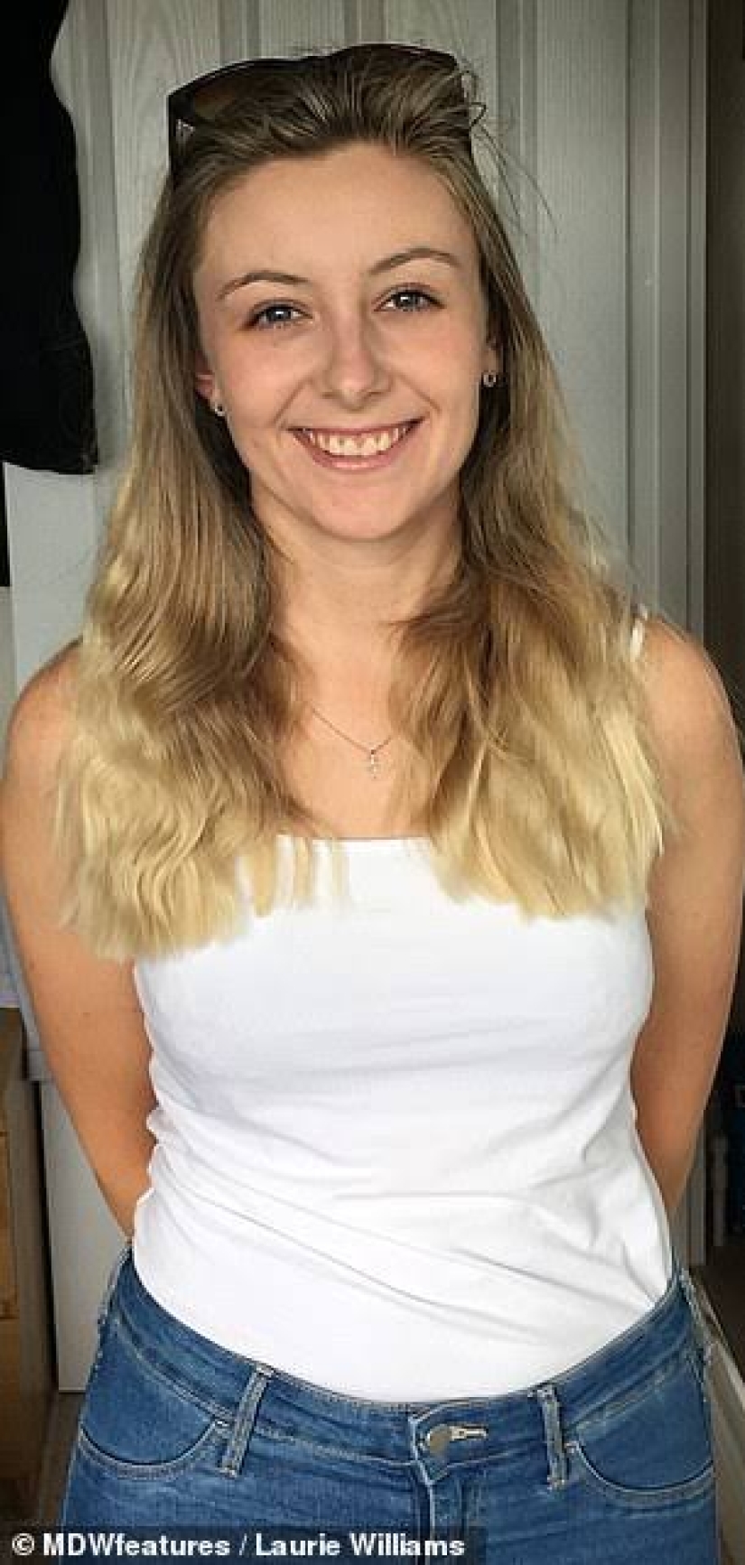 The result is evident: a woman got rid of the horrible eczema, throwing cream on steroids and becoming a vegetarian